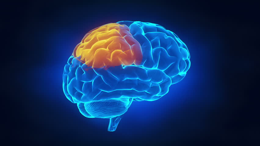 Isolated Damage To Frontal Lobe Of Brain After A Thrombus Or Embolus