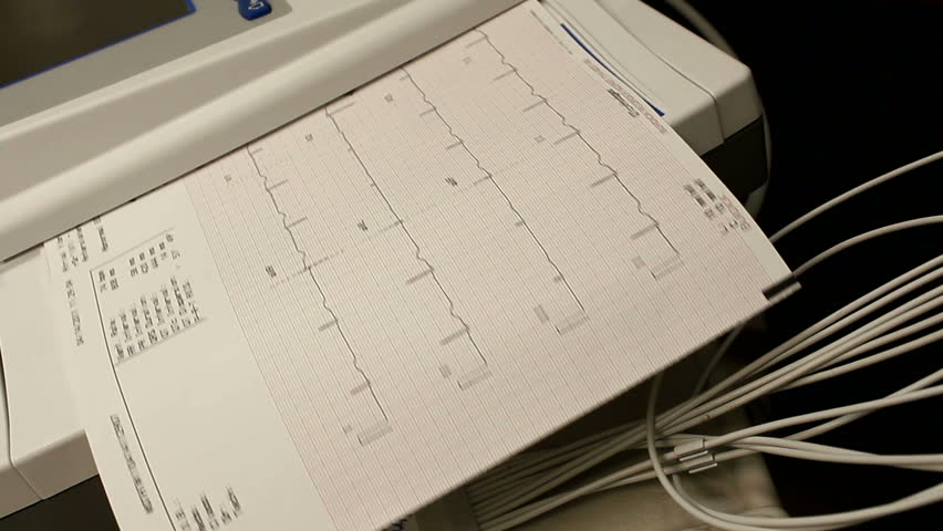 Physician reviews EKG readout. 1080p