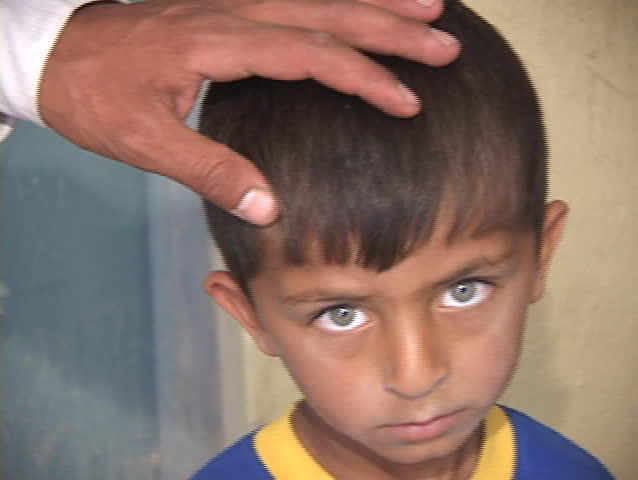 IRAQ - CIRCA 2003: A young Iraqi boy shows the effects of war in his sad face circa 2003 in Iraq.