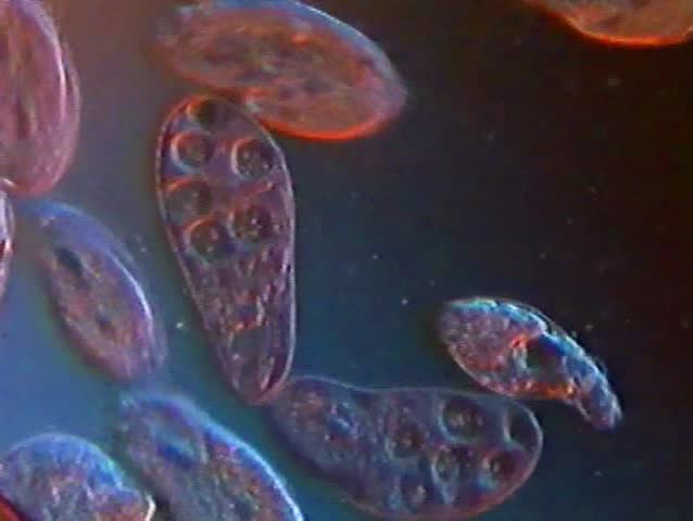 Educational microscopic:Two kinds of Protozoa (Blepharisma and Oxytricha) compete for available room along with a couple of Rotifers (Lepadella).  Oblique Rheinberg illumination