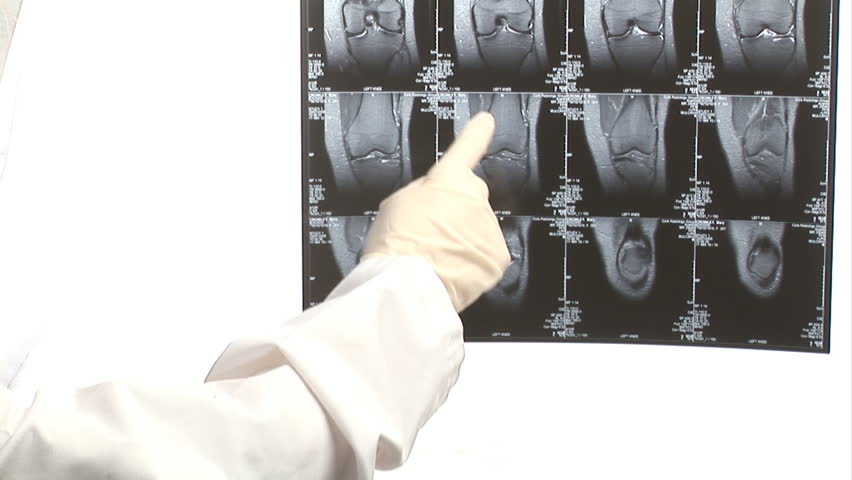 Examining an MRI Scan