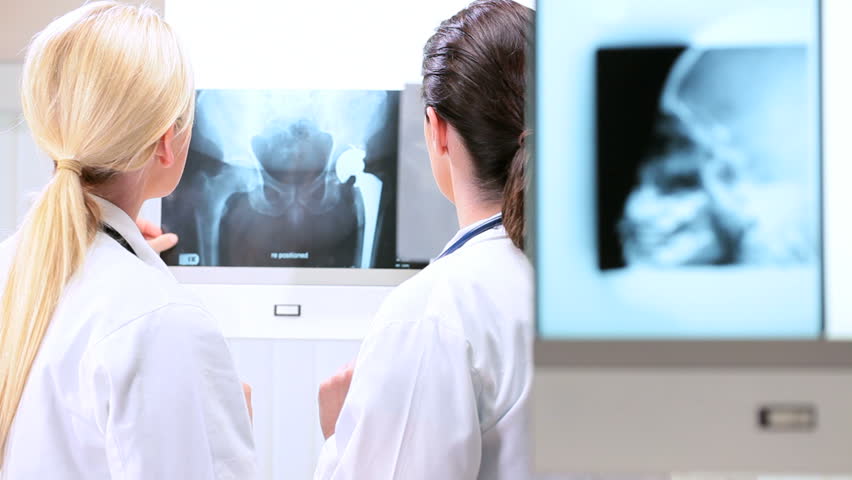 Young female doctors in hospital radiology department inspecting x-rays