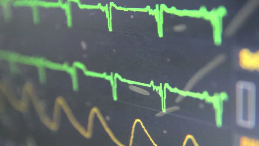 Heart monitor detail