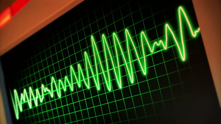 A fictional hospital computer screen monitoring a human heart.  