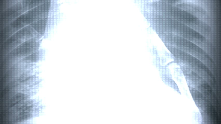 xRay Fast Motion in HD -Xray Scans flying by at high speed 1080p