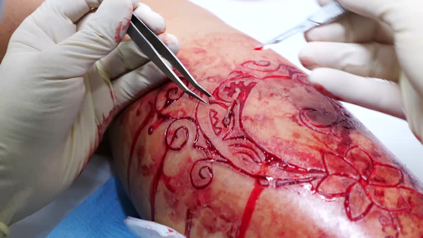 Header of Scarification