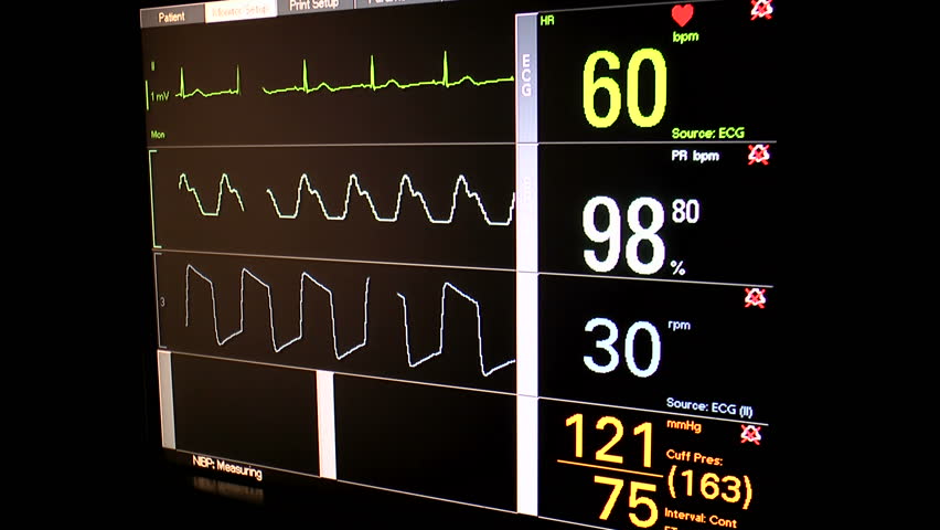 Patient screening checkup displays ECG or EKG heart rate, SP02 or oxygen saturation, respiration and blood pressure readings on vital signs monitor, black background. 1080p