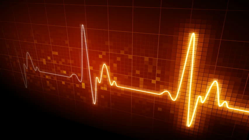 Seamlessly looping heart monitor. 