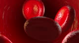 Carbon monoxide CO avidly binds to hemoglobin