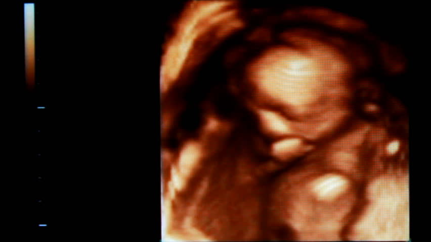 baby ultrasound 3D video