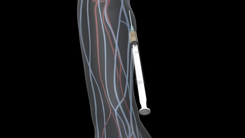 3D perspex forearm rotating black background showing syringe with needle injecting into vein of cubital fossa 