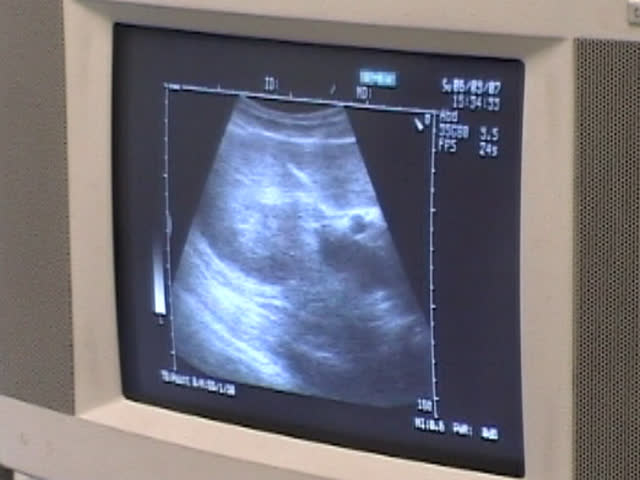 Ultrasonic inspection on the monitor