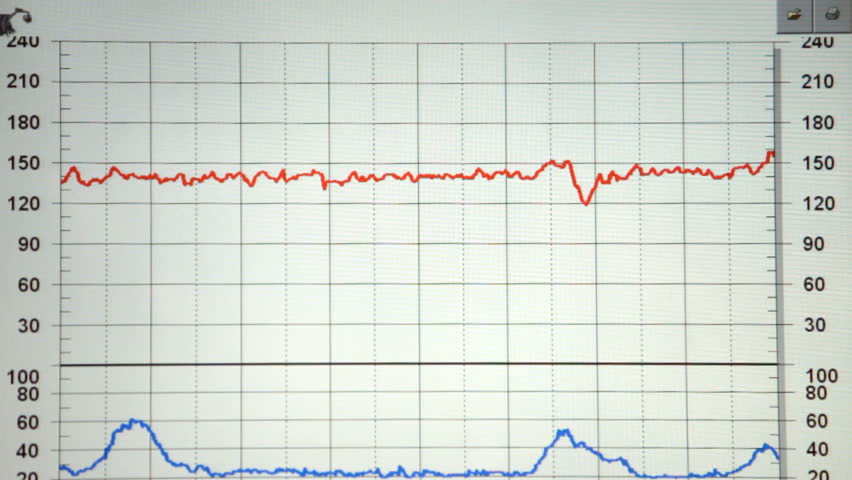 Hospital monitor that records cardiac heart information in a maternity ward. Hospital equipment in background. Preparation for surgery or check up.
