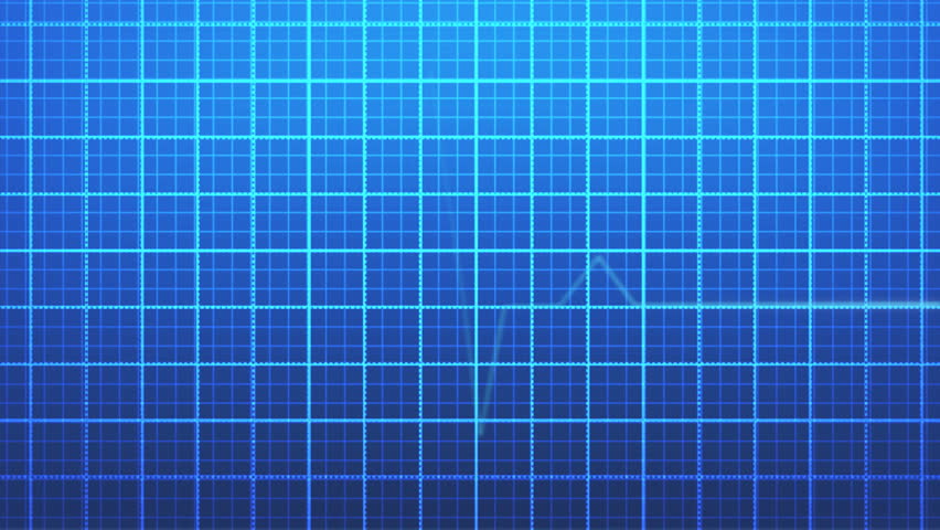EKG heart rate monitor AUDIO INCLUDED