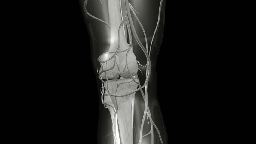 HD Knee X-ray