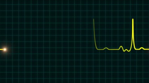 Animated Ekg Heartbeat Monitor Yellow Wave Stock Footage Video (100%  Royalty-free) 10765664 | Shutterstock
