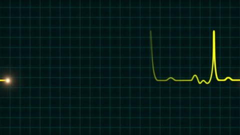 Animated Ekg Heartbeat Monitor Yellow Wave Stock Footage Video (100% Royalty-free) 10765664 | Shutterstock Animated Ekg Heartbeat Monitor Yellow Wave Stock Footage Video (100% Royalty-free) 10765664 | Shutterstock