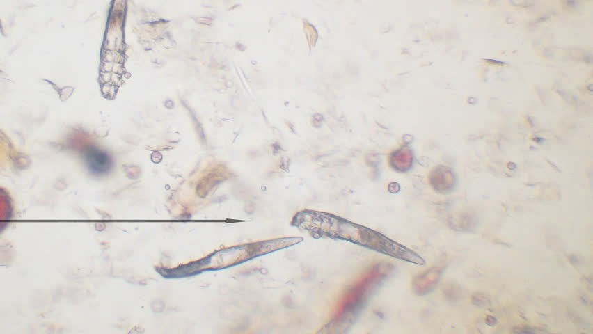 demodex canis mites