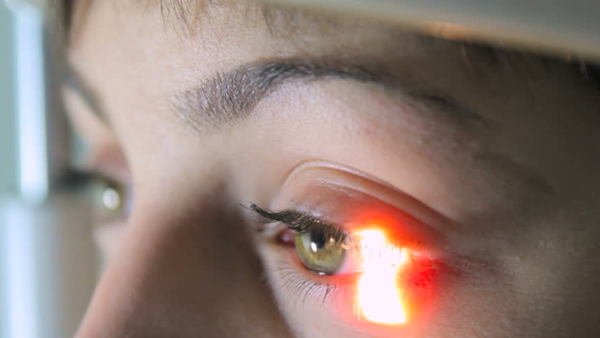 Header of retina