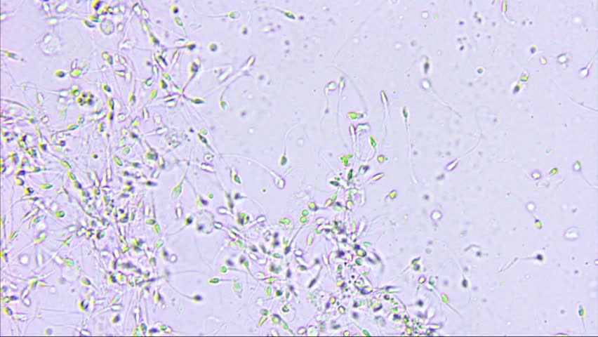 Sperm 600x Microscope - Micropedia