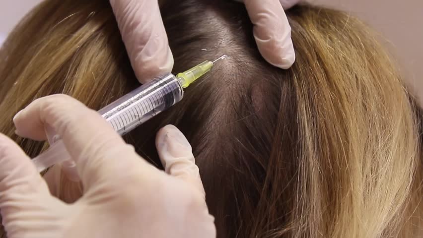 Header of alopecia