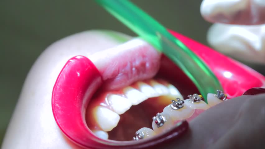 Header of ejector