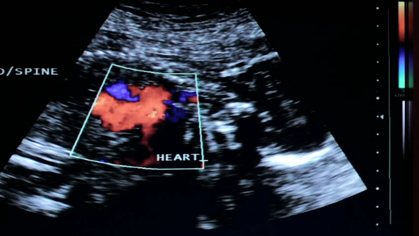 Header of trimester