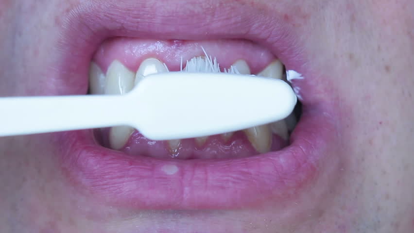 Bleeding Gums When Brushing Teeth Stock Footage Video (100% Royalty