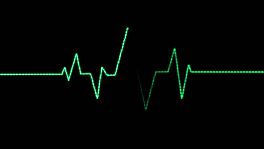 heart monitor line